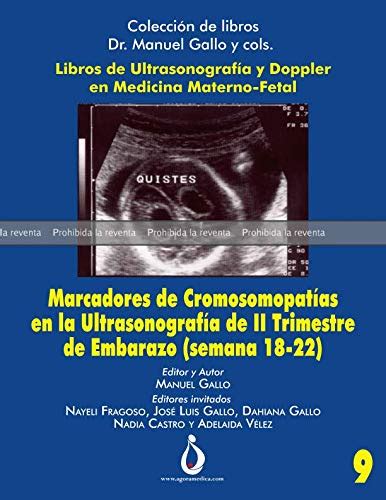 Prueba Marcadores Cromosomopatías En La Ultrasonografia De Ii Trimestre De Embarazo Semana 18
