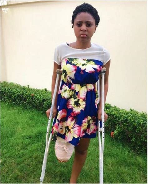 Juxxt Blog Nigerian Actress Regina Daniels Leg ‘amputated’