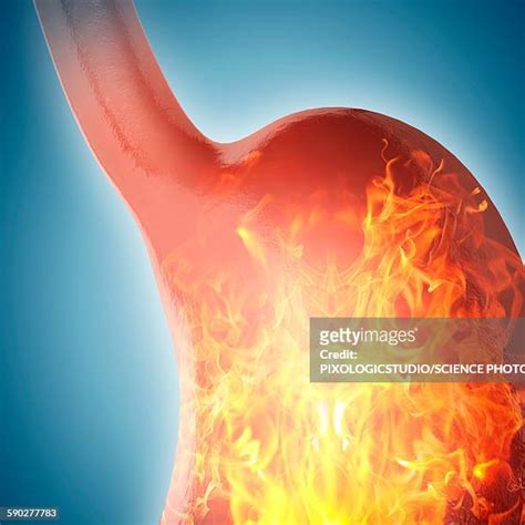 What Color Is Stomach Acid Photos And Premium High Res Pictures Getty