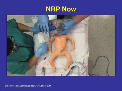 Ppt Neonatal Resuscitation Program And Helping Babies Breathe