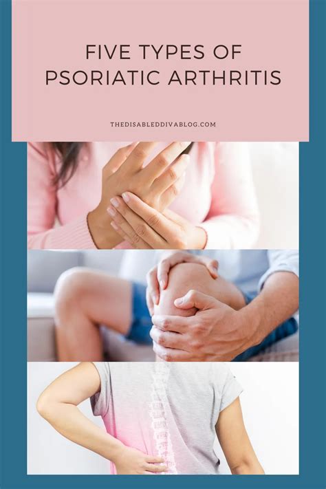 Five Types Of Psoriatic Arthritis Artofit