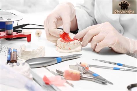What Are The Different Types Of Dentures Elite Dental Care Tracy