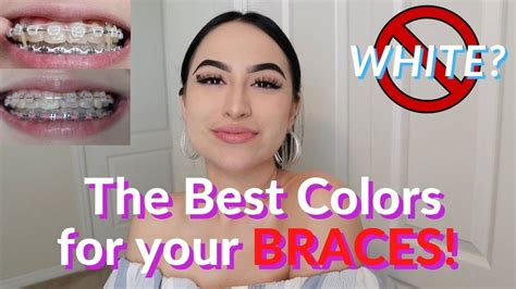 Best Braces Colors For Brown Skin Get More Anythinks