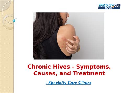 Chronic Hives Symptoms Causes And Treatment By Specialty Care