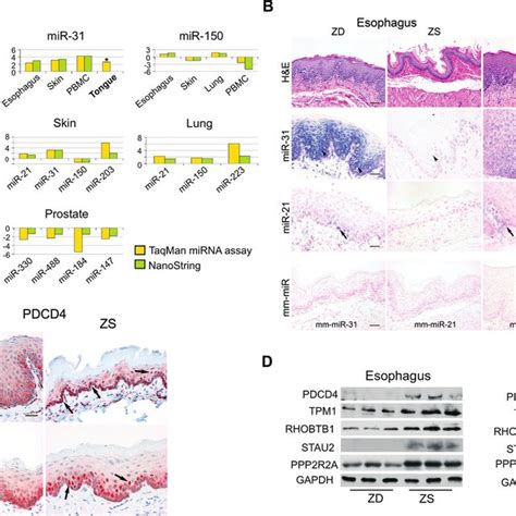 mirna expression profiles of zd esophagus and six additional tissues download scientific