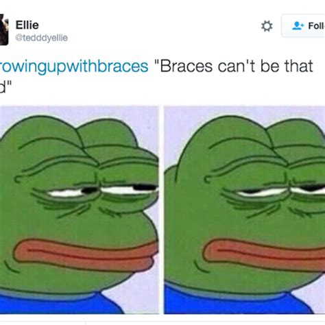 21 Photos That Are Too Real For Anyone Who Wore Braces Memes Of The Day Memes Funny Memes