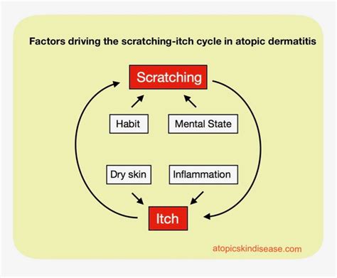 Not Only Itch Causes Scratching G In Atopic Dermatitis