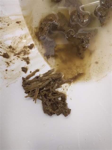 Strange Poop Texture Is This Normal Rpoop