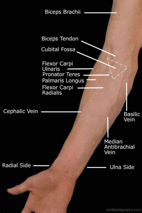 Each tunnel is lined internally by a synovial sheath and separated from one another by fibrous septa. Pin on Tennis Elbow and Golfers Elbow