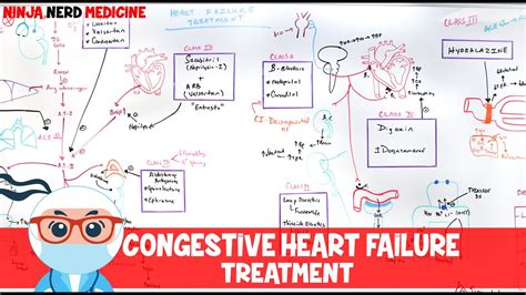 Congestive Heart Failure Treatment Youtube