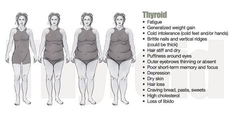 Characteristics Of The Thyroid Body Type What And Where Is Your Thyroid It Resides In The Front