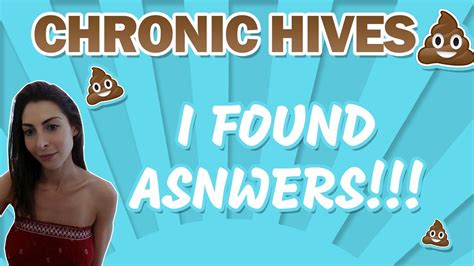 Chronic Hives I Found Answers What Causes Ciu How To Treat