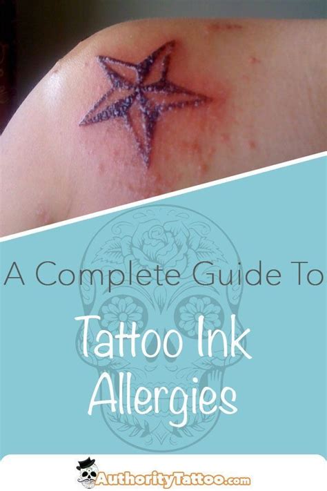 What Causes A Tattoo Ink Allergy And How To Treat It Tattoo Ink Allergy