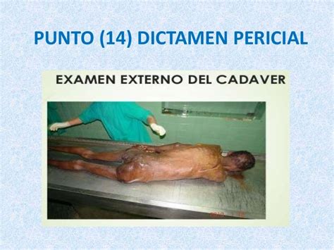 Examen Externo