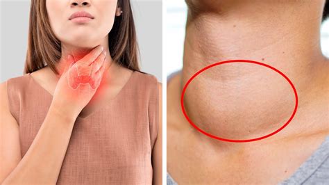 7 Signs Of Thyroid Problems You Should Never Ignore Youtube