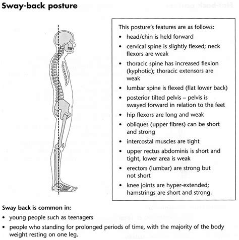 Clients Adopt Many Postures Sway Back Pacific Nw Pilates Sore