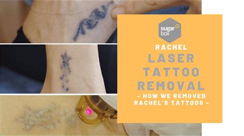 Tattoo fading methods that work. How can I remove my tattoo? - YouTube