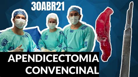 dr lucas duarte conventional appendectomy apendicectomia convencional youtube