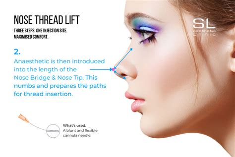 All You Need To Know About Nose Threadlift In Singapore Sl Aesthetic
