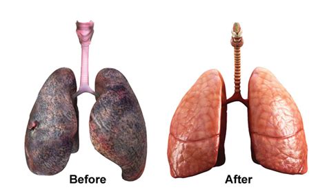 pot smokers lungs before and after