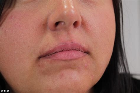 Beauty Therapist Left Feeling Like A Freak After Wonky Lip Liner