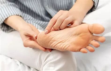 20 Home Remedies For Cracked Heels Causes Prevention Tips Artofit