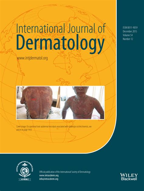 International Journal Of Dermatology Vol No