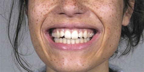 The Science Of Genuine Smiles Huffpost