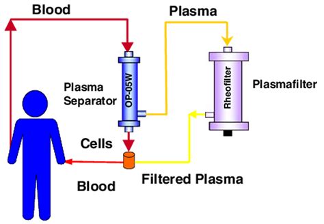 Plasmapheresis Indications Plasmapheresis Side Effects