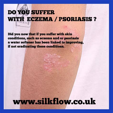 Do You Suffer With Eczema Psoriasis Silkflow