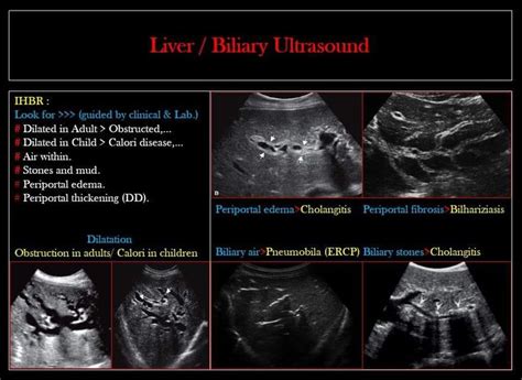 Pin By Brittney Parsons On Sonography Medical Ultrasound Diagnostic
