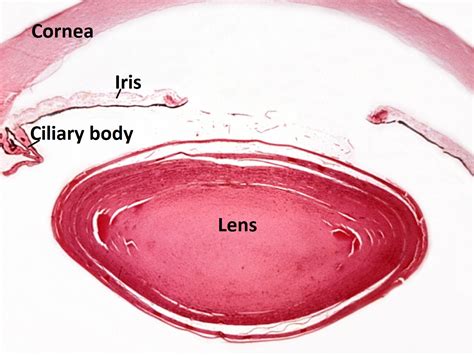 Moran Core Lens Histopathology