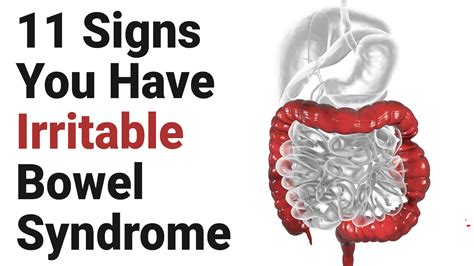 11 Signs You Have Irritable Bowel Syndrome Irritable Bowel Syndrome