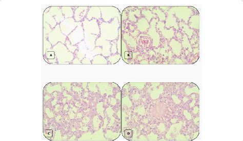 Histopathological Changes In Lung Tissue From A Control And Ajwa