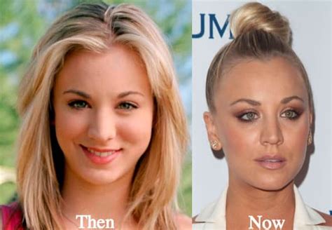 Kaley Cuoco Plastic Surgery Before