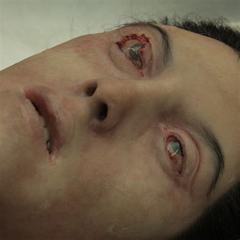 Woman Autopsy Body Vincent Van Dyke Effects