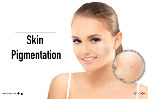 Skin Pigmentation By Dr Latika Arya Lybrate