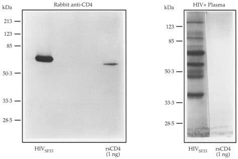 Immunoblot Assay Of Hiv 1sf33 Propagated In Cd4 Positive Vb Cells A Download Scientific