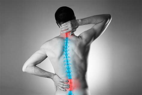 Neck Pain And Cervical Spondylosis