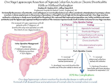 One Stage Left Colon Resection For Chronic And Acute Diverticulitis With Or Without Perforation