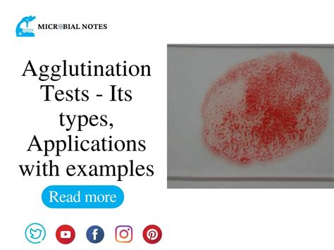 Agglutination Tests Its Types Applications With Examples Microbial