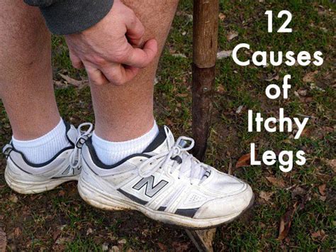 12 Causes Of Itchy Legs And How To Cure Them Brofist Nation