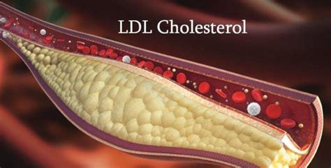 Meskipun ada rentang detak jantung normal yang luas, detak jantung yang tinggi atau rendah bisa jadi tanda masalah kesehatan. Waspadai Kadar Kolesterol LDL Melebihi Batas Normal ...