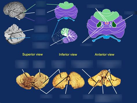 Cerebellar Anatomy Diagram Quizlet