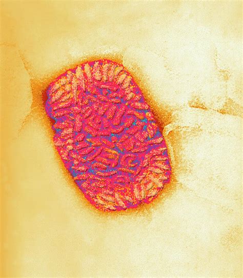 Vaccinia Virus Particle Photograph By Ami Imagesscience Photo Library