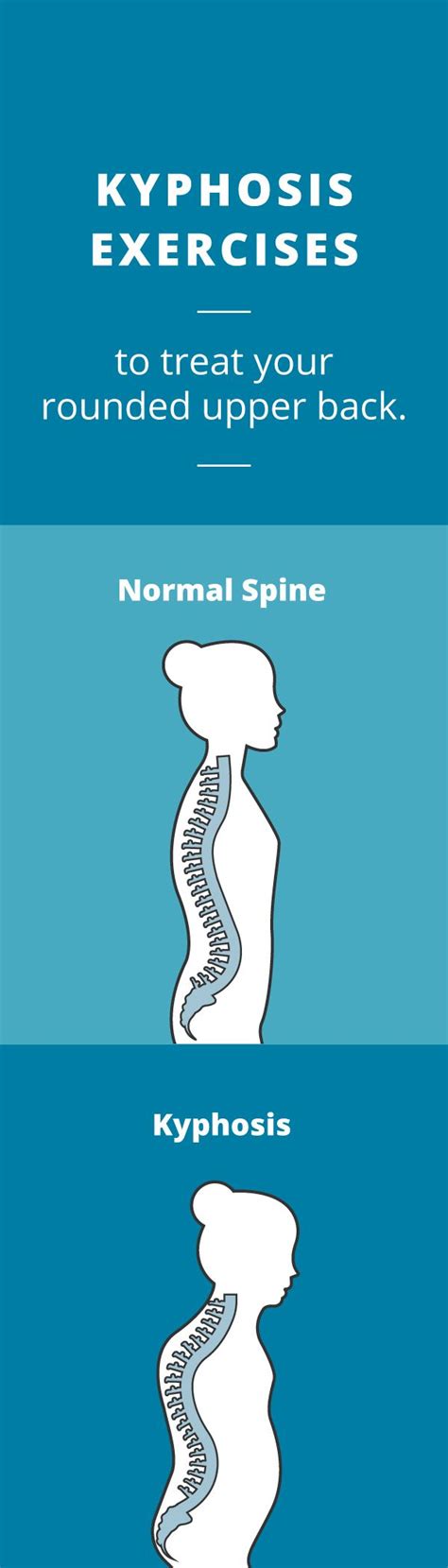 Kyphosis Exercises Treat A Rounded Upper Back With Images Kyphosis