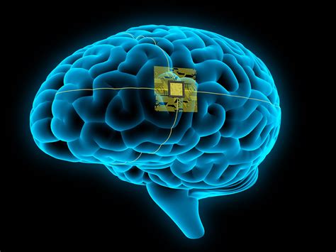 Asu Professor On The Plausibility Of Elon Musks Brain Implant Plans