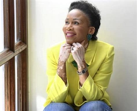 “vitiligo Does Not Define Who I Am” Leleti Khumalo Youth Village