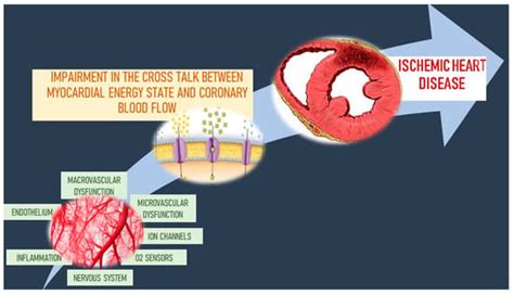 Ijms Free Full Text Ischemic Heart Disease Pathophysiology