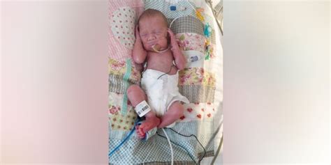 Mom Who Nearly Died Of Sepsis Shocked To Discover She Had Given Birth